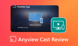 Examen du casting Anyview
